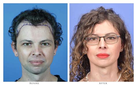 Transgender Pictures .